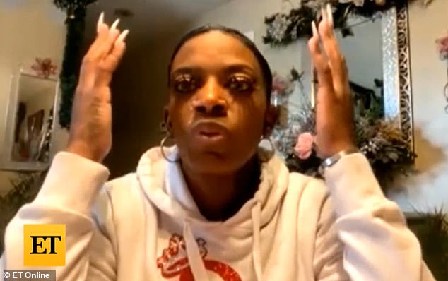 TikTok Woman uses Gorilla Glue to Fix Hair for 'Fame and Money' Ends up at Plastic Surgeon to Remove it 2 39128124 9246079 image a 4 1612982469694