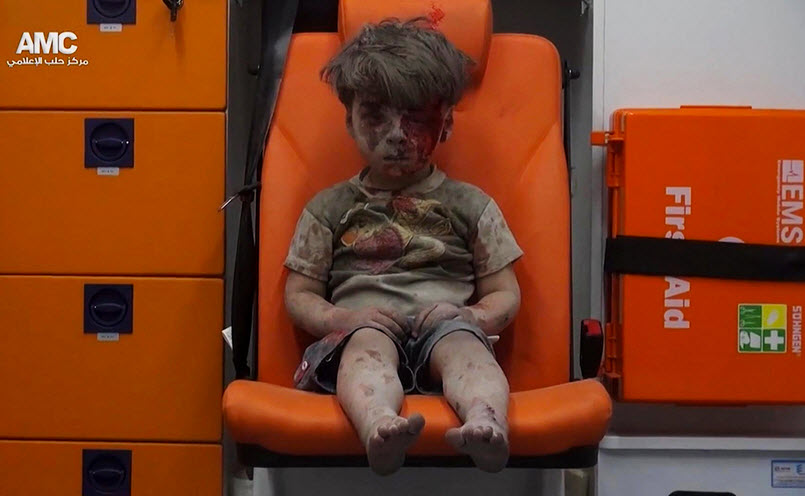 Father of ‘Aleppo boy’: Corporate Media Used My Son as a Political Tool, Lied about Attack 2 7BPBSpv