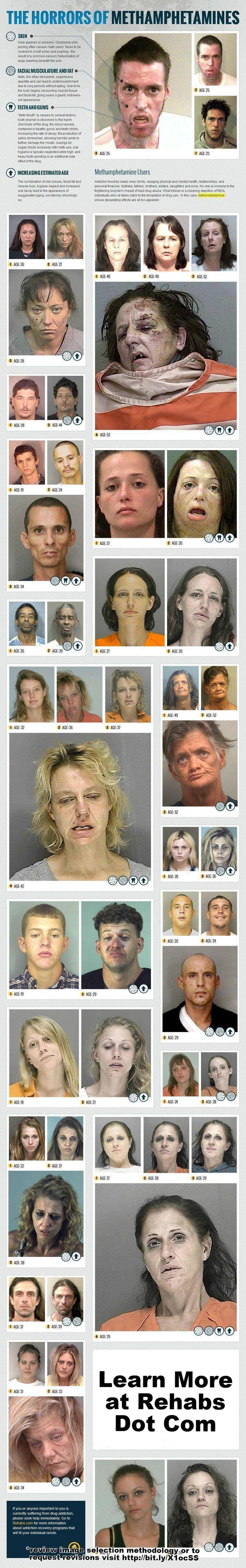 Shocking photo gallery of Meth drug addicts and its side effects 6 ESwXO