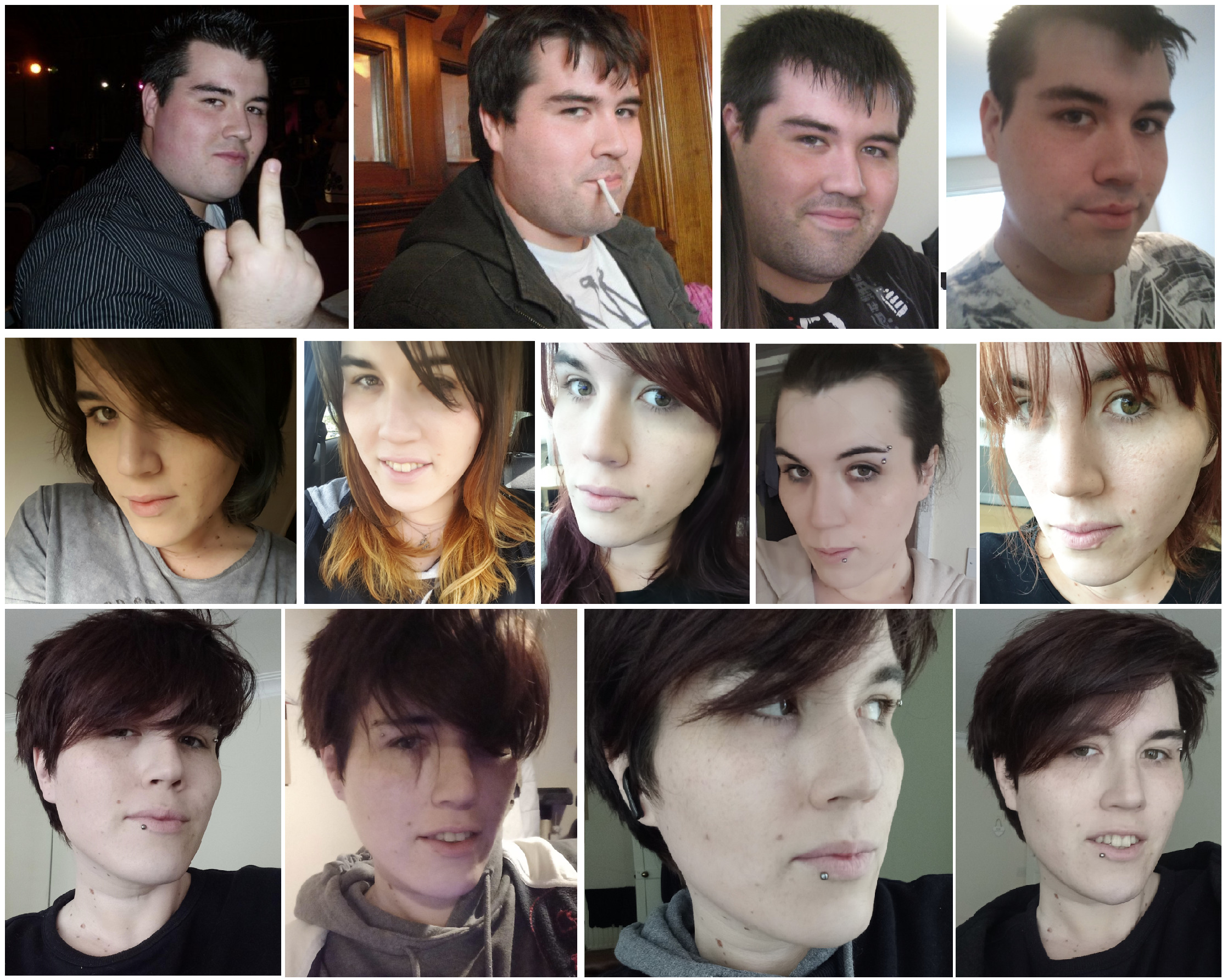 UK Transgender man who is trying to Detransition Shares Grim Details of Trans Surgeries 2 EzmbZZ1