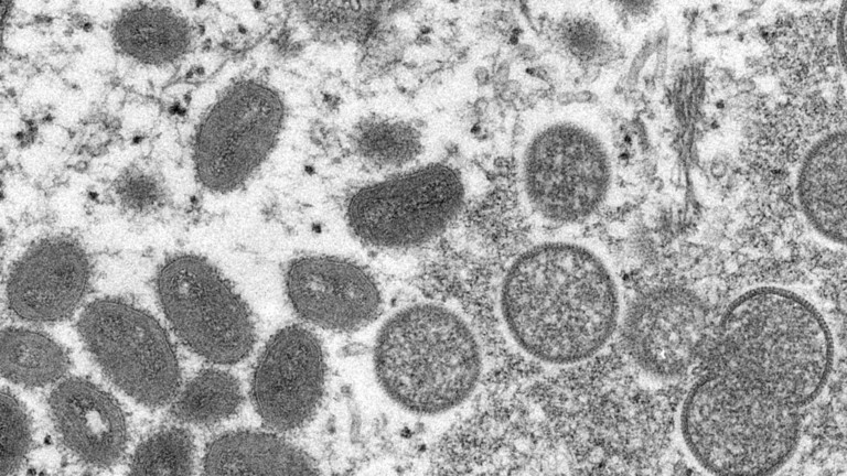US buys millions of Vaccine Doses for new Monkeypox Virus 1 Monkeypox Virus
