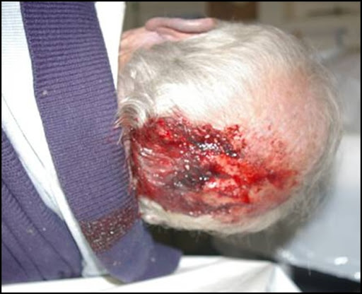 Police-jail rapes of white SA men is a war crime pattern 2 AlzheimersuffererJamesBrown12