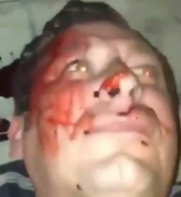 Muslims kill white man for fun in Nice France then post video on Social Media 2 gtO8Hav