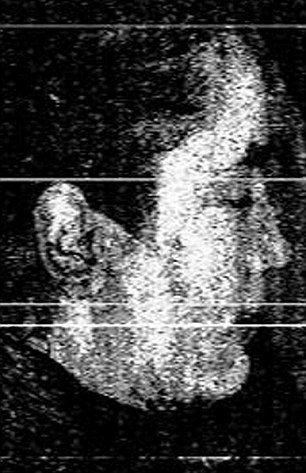 Moscow metro bombings: Chechyna link emerges 3 The first images of the 'Black Widow' suicide bombers