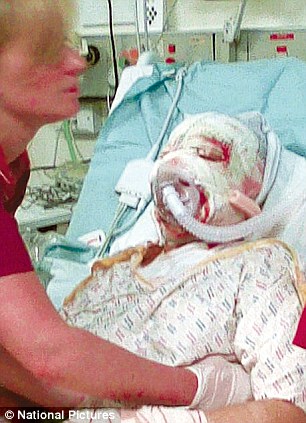 British model Katie Piper attacked by her savage boyfriend with acid on her face 4 article 1351435 0CF5E142000005DC
