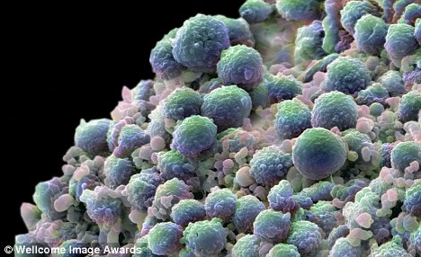 Prostate cancer's genetic code cracked by US scientists in treatment breakthrough 2 article 1355456 0091D54500000578