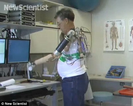 Bionic arm controlled by the mind 1 article 1356079 0D2402AF000005DC