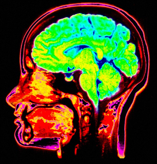 Brain Scanner Reads and Records People's Dreams 2 article 0 0A0AD2AC000005DC