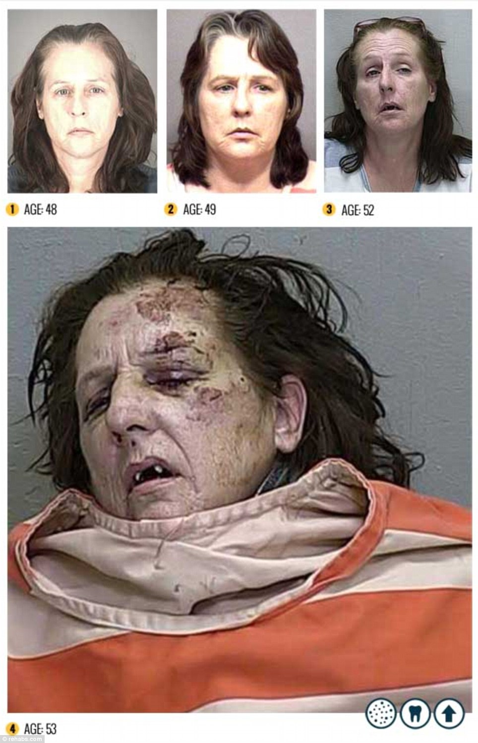 Shocking photo gallery of Meth drug addicts and its side effects 2 article 0 1661996A000005DC