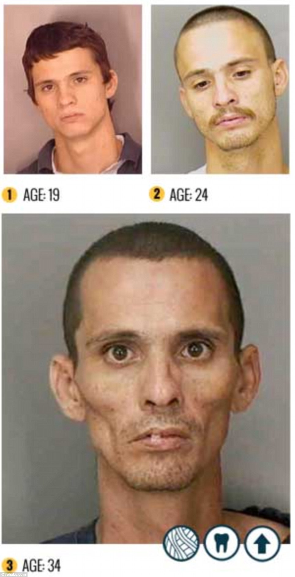 Shocking photo gallery of Meth drug addicts and its side effects 5 article 2244031 166199D3000005DC