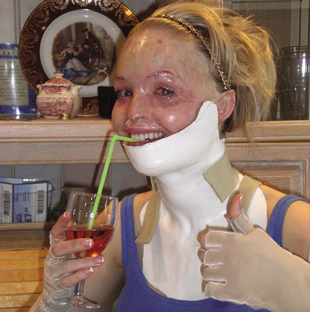 British model Katie Piper attacked by her savage boyfriend with acid on her face 6 article 2732788 209493F300000578