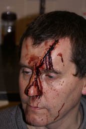 BNP Campaign Worker Beaten with a Hammer by Leftist Thugs 1 bnp attack