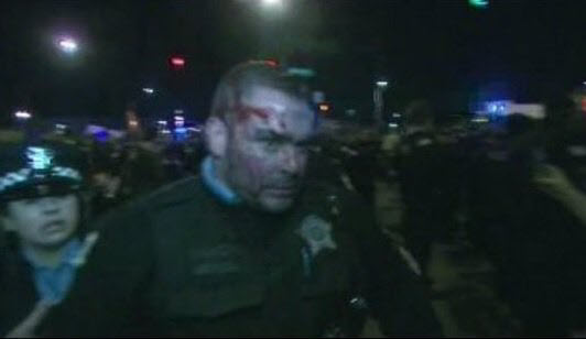 Ted Cruz Loses Police Votes After Siding With Bill Ayers, Violent Mobs in Chicago 2 chicago cop bleeding 1