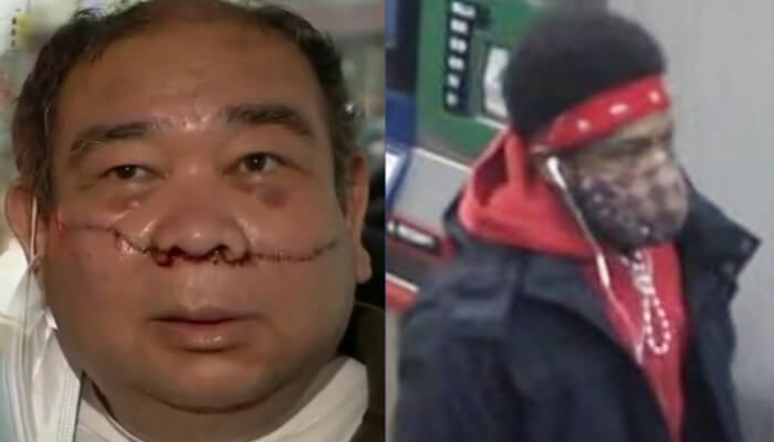 New York leftists Condemn White People for Slashing of Asian man's Face despite the Attacker being Black 2 Noel Quintana with Attacker